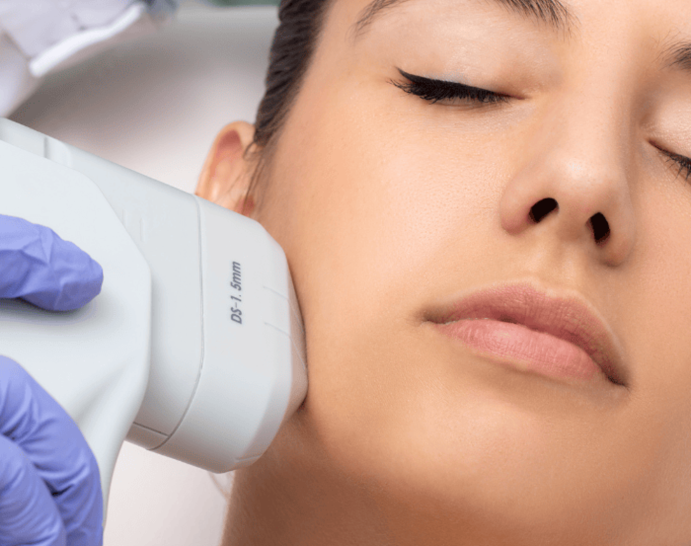 HIFU Skin Tightening in Castro Valley, CA